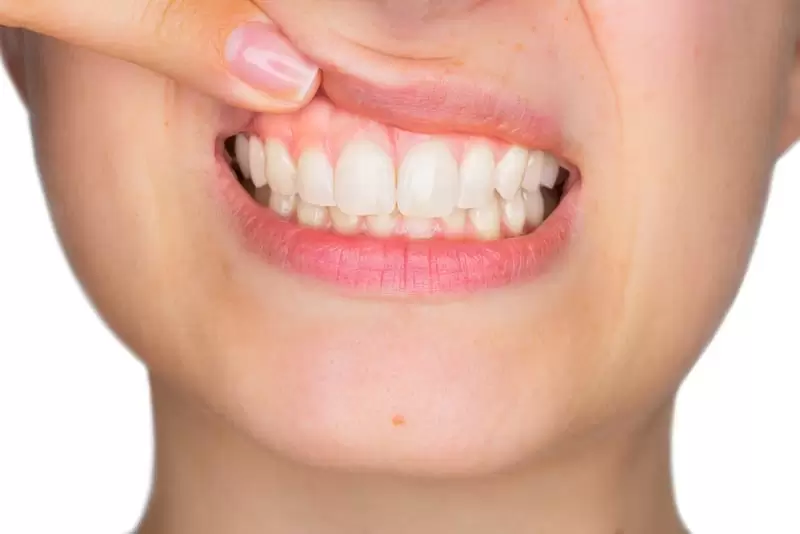 Young woman showing off her healthy gums