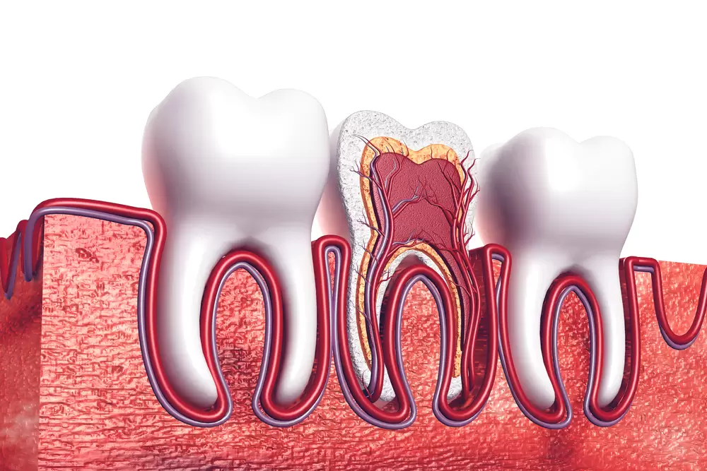 image graphic of root canal