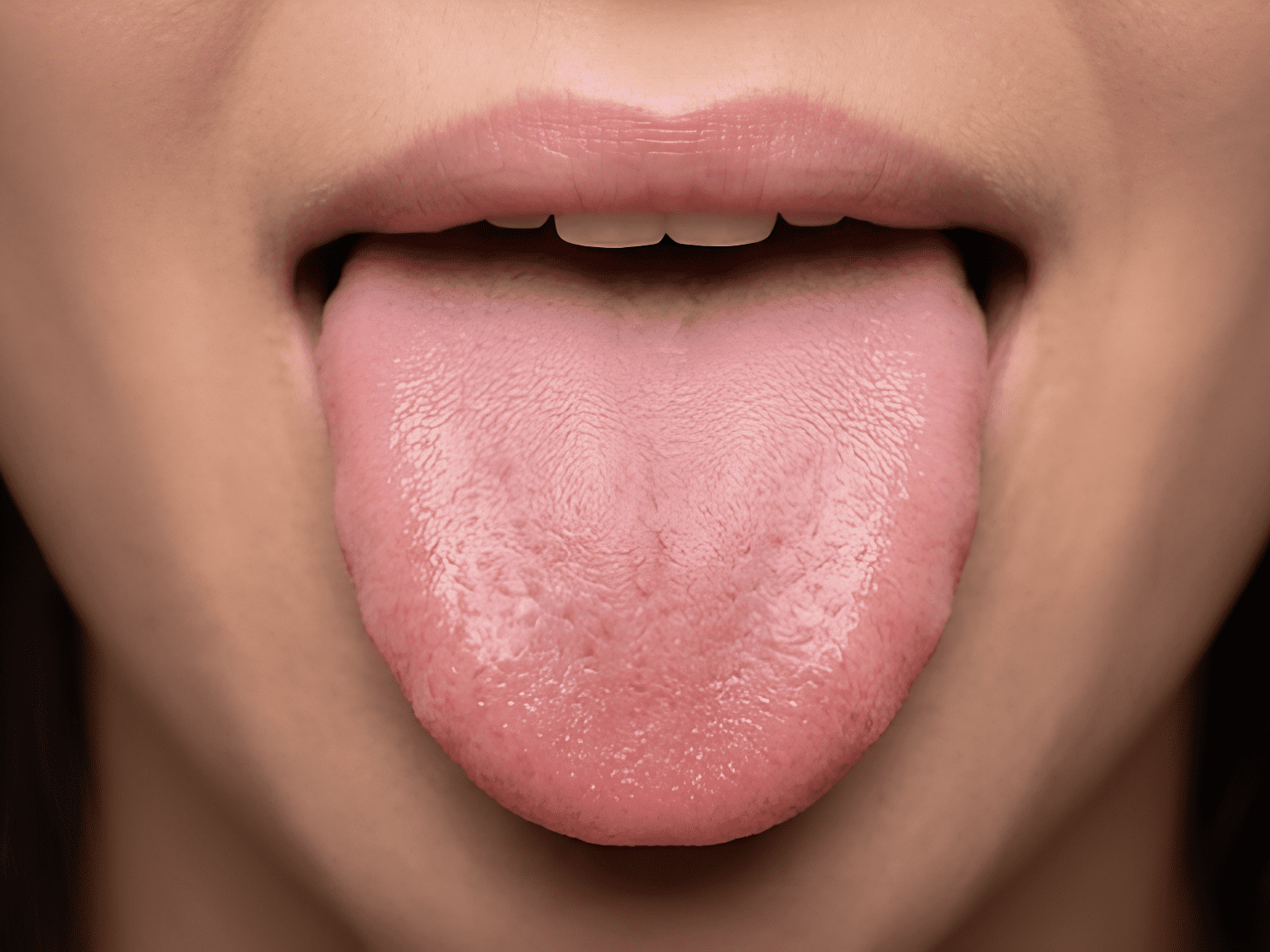 What a Healthy Tongue Usually Looks Like