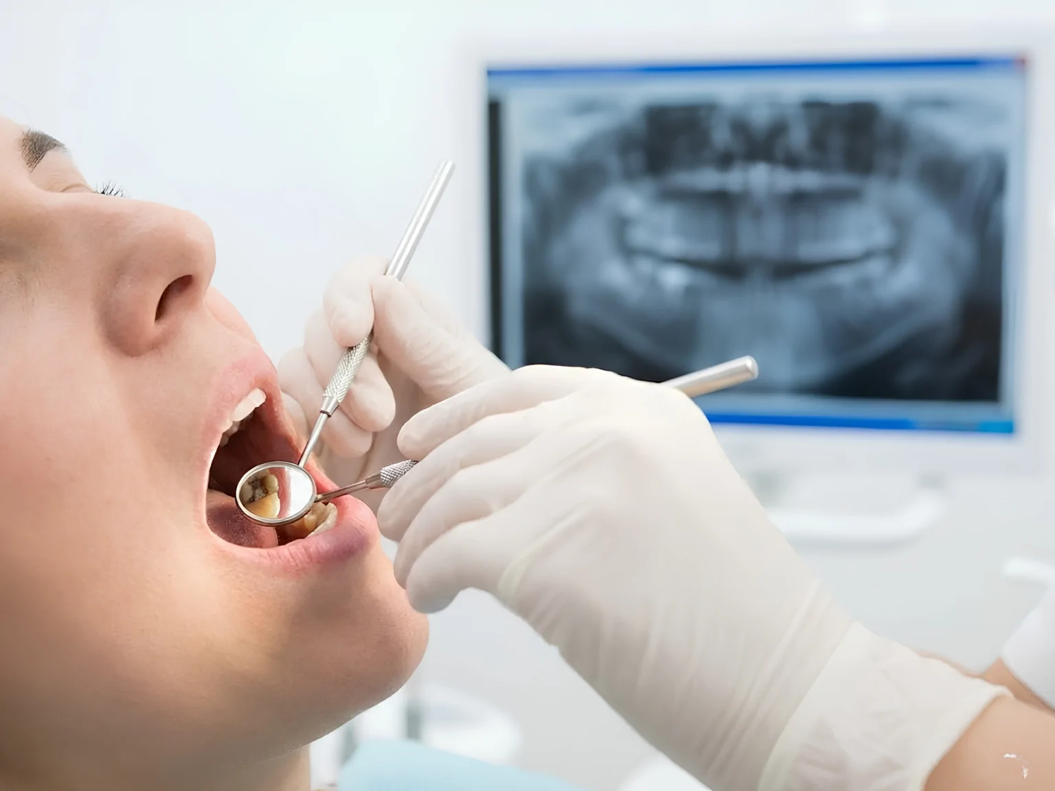 Loose Fillings and Worn Dental Work Matter Too